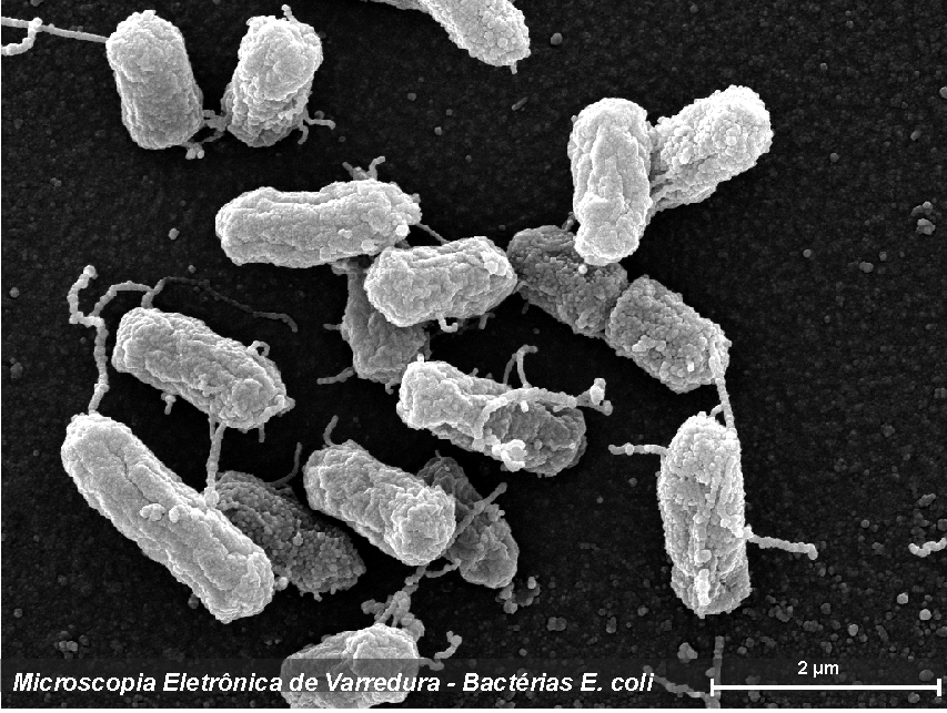 5. feg bacteria.png